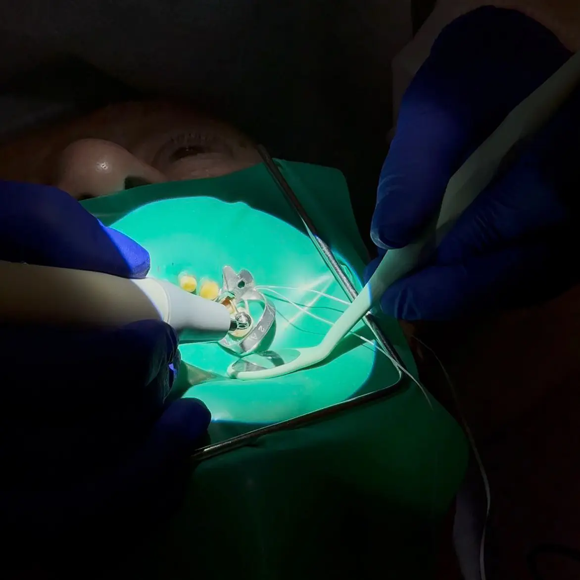 Servicii Stomatologie Constanta