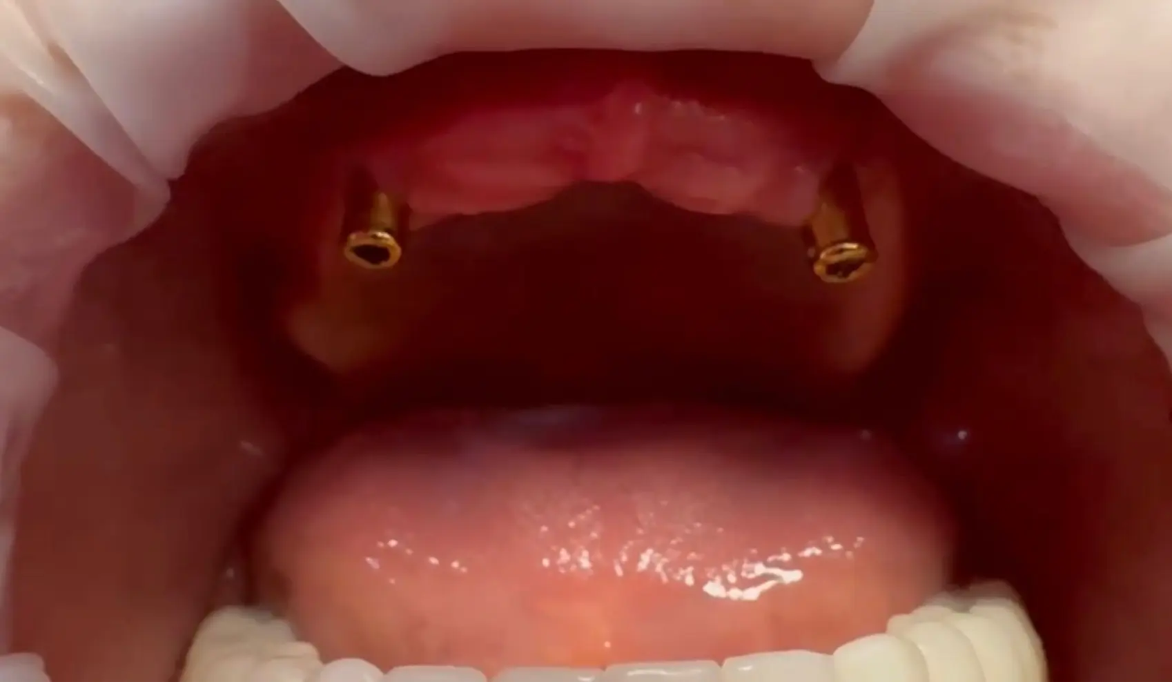 Servicii Stomatologie Constanta