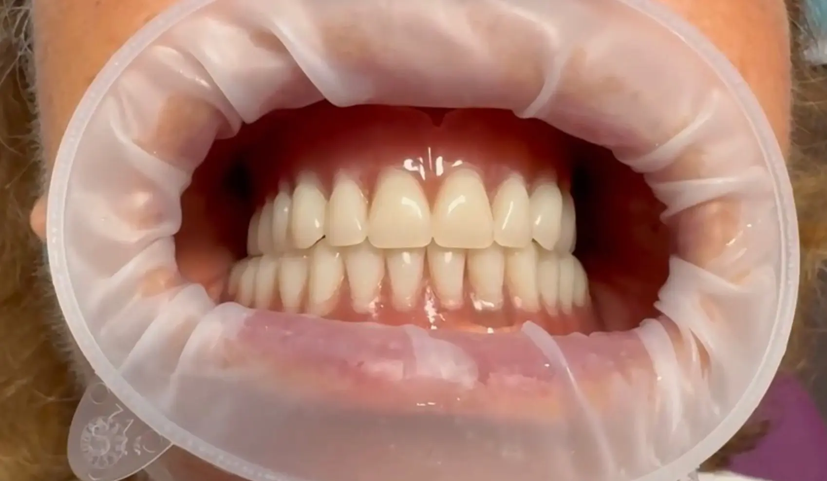 Servicii Stomatologie Constanta